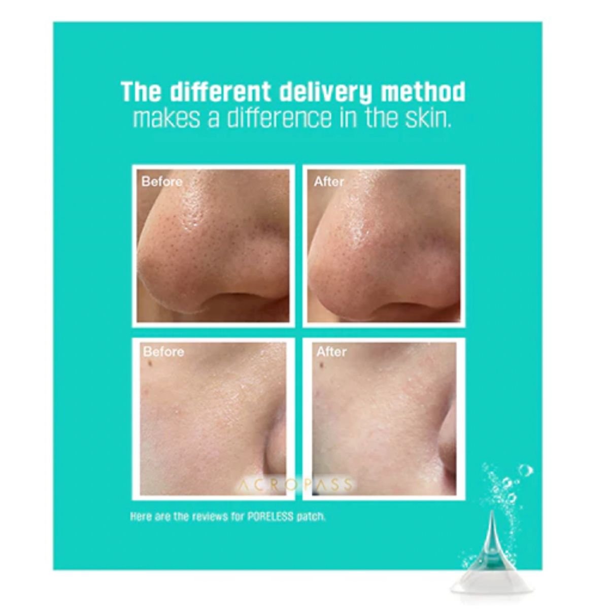 Poreless Patch