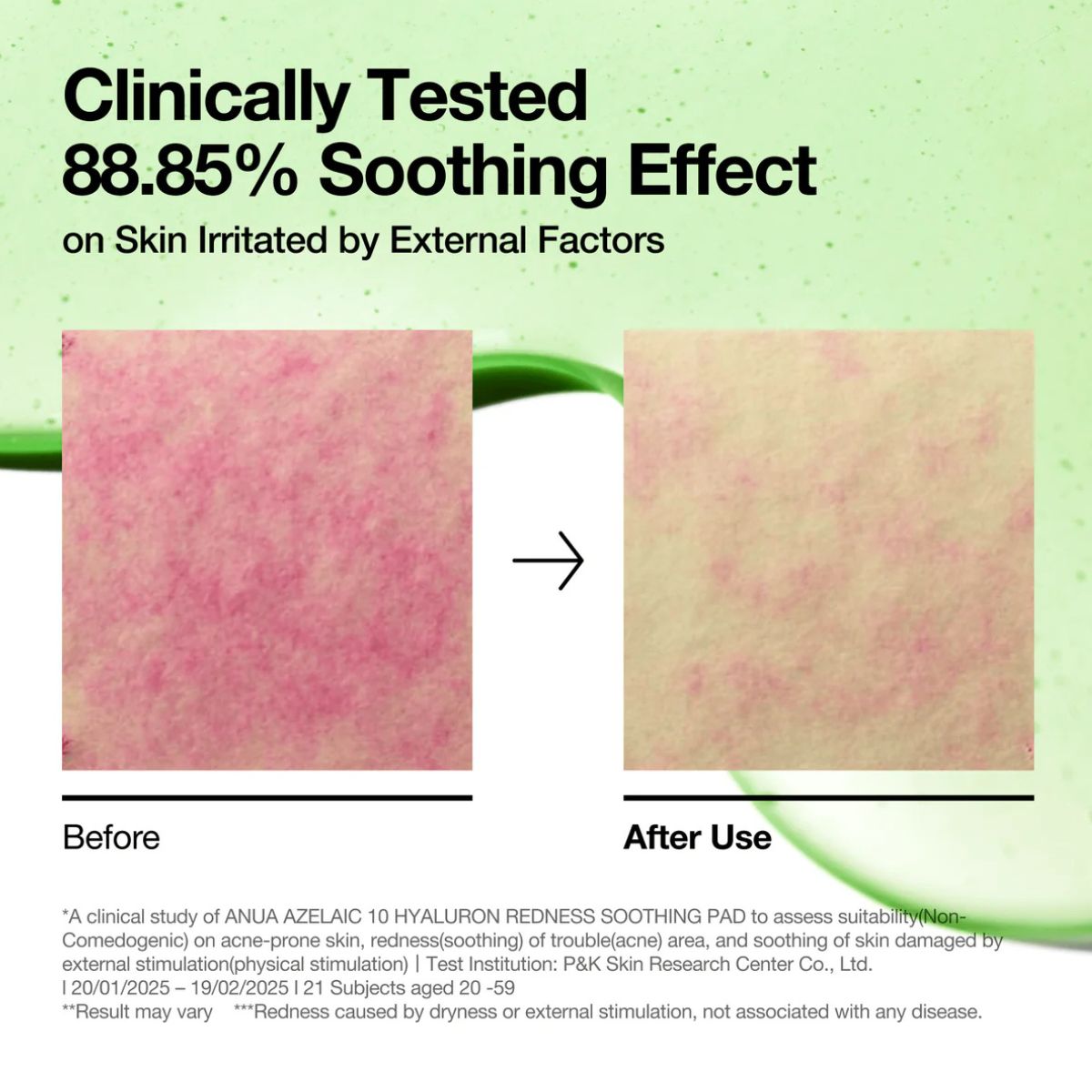 Azelaic Acid 10 Hyaluron Redness Soothing Pad 90ea