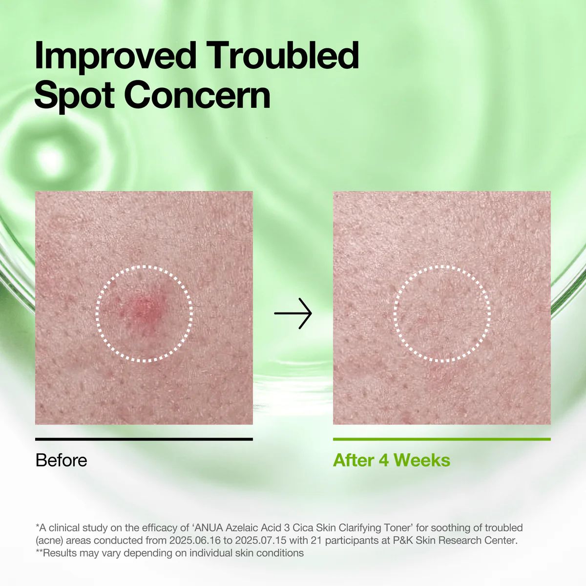 Azelaic Acid 3 Cica Skin Clarifying Toner 250mL