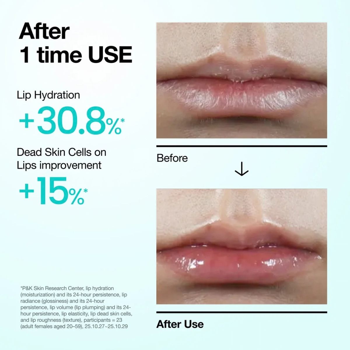 PDRN Lip Serum 10mL