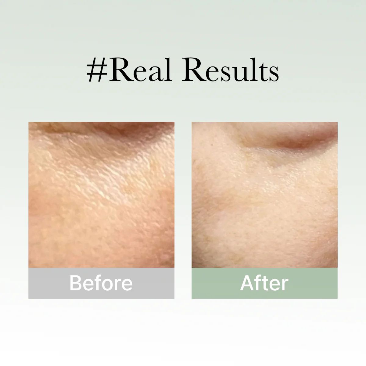 Holy Hyssop Serum 30 50g