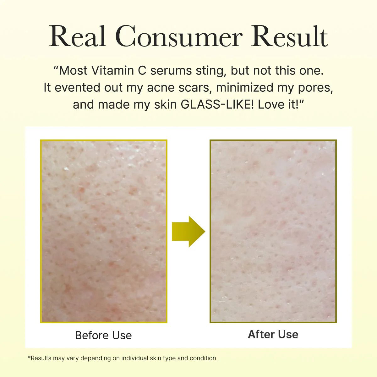 Vitamin C Booster Shot 30mL