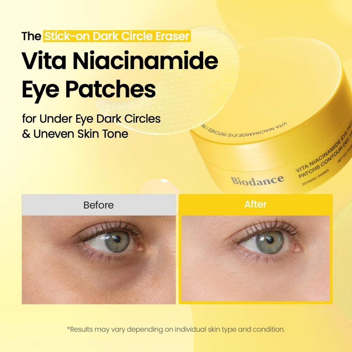 Vita Niacinamide Eye Patches (30ea)