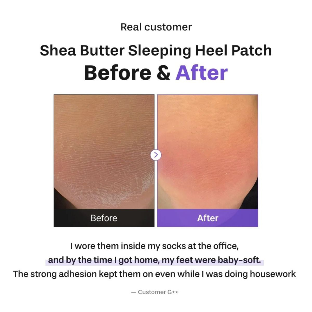 Shea Butter Sleeping Heel Patch 10ea