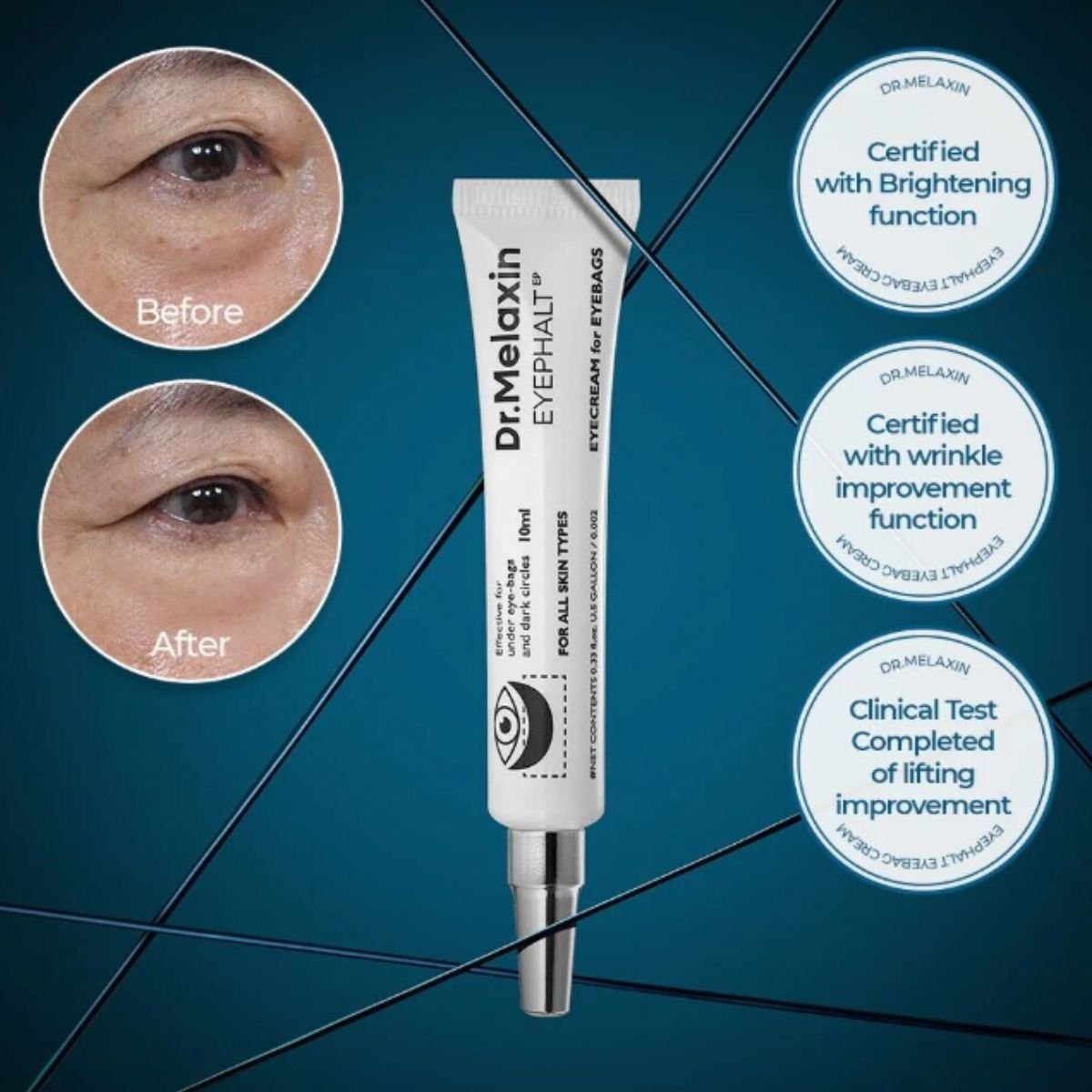 Eyephalt Eyebag Cream 10mL