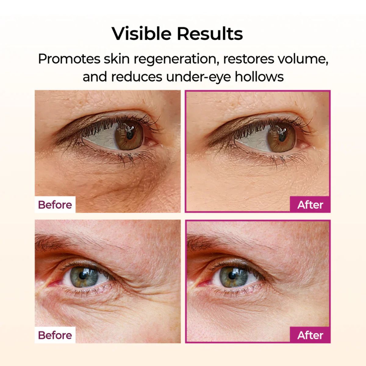 Cemenrete Calcium Volume Multi Balm 9g