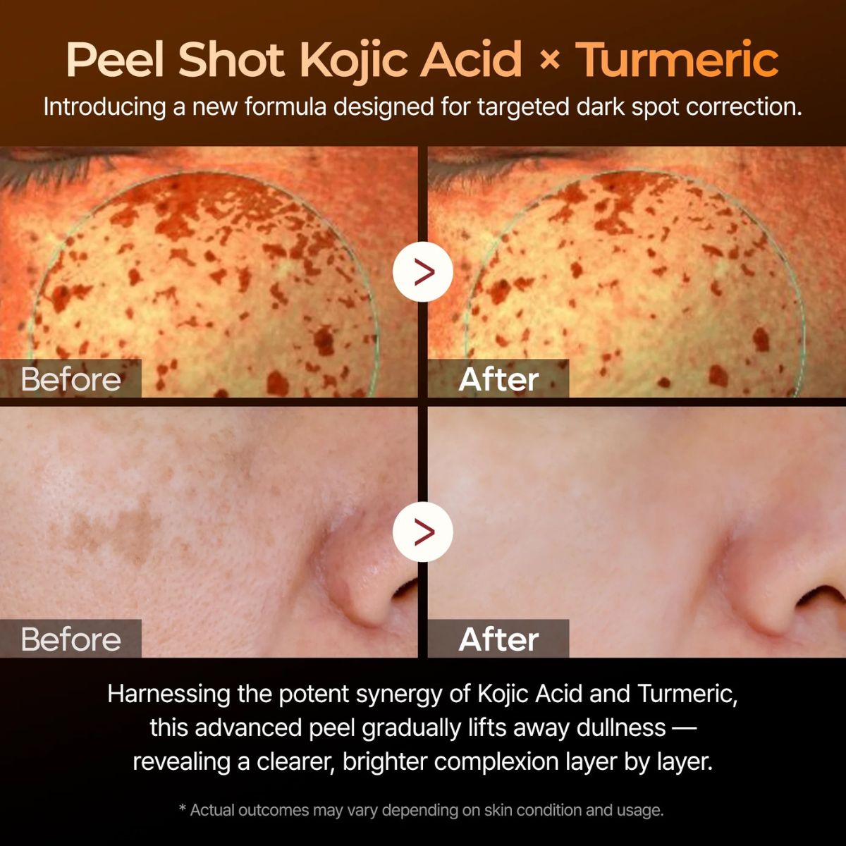 Peel Shot Exfoliating Kojic Acid Turmeric Serum 80mL
