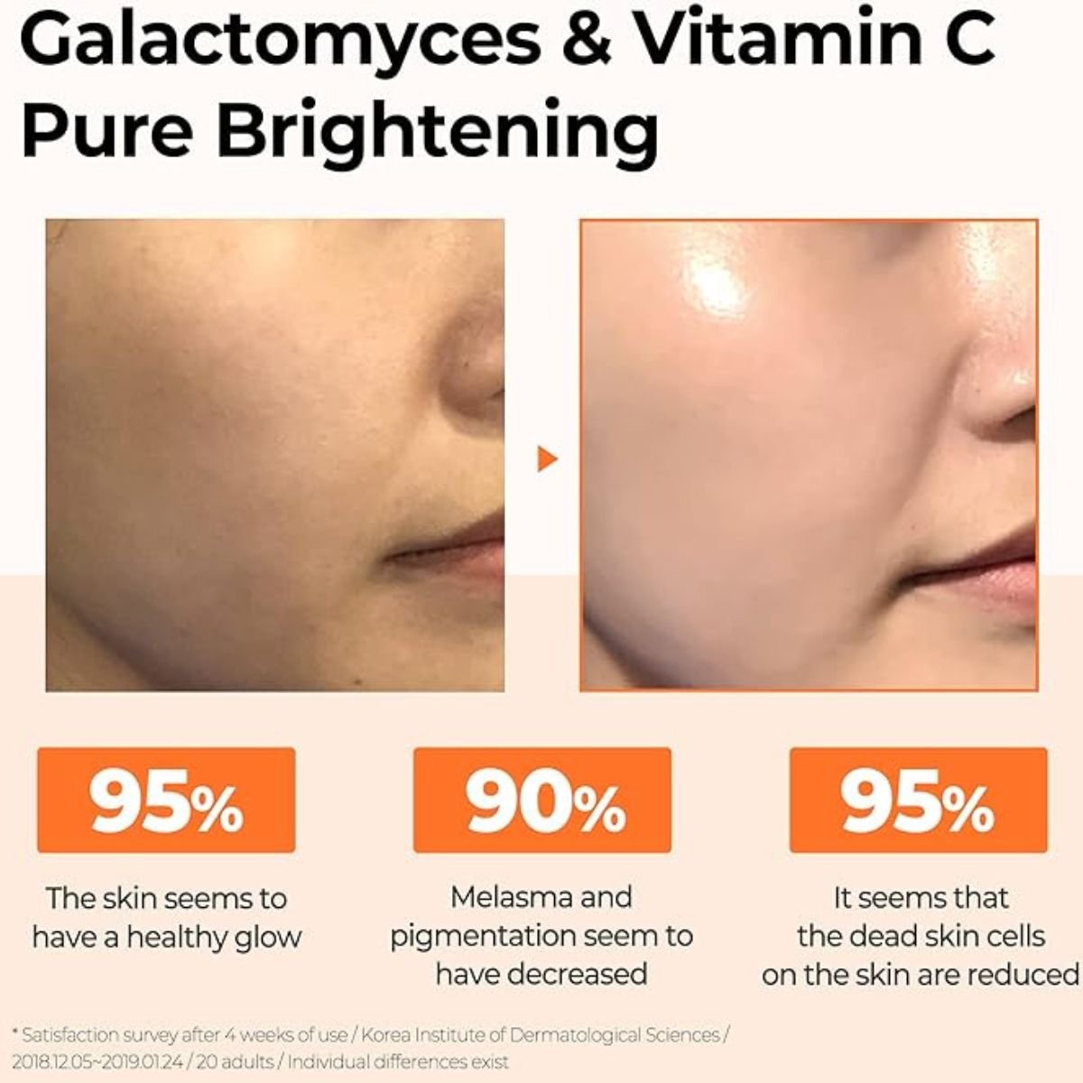 Galactomyces Pure Vitamin C Glow Serum 30mL