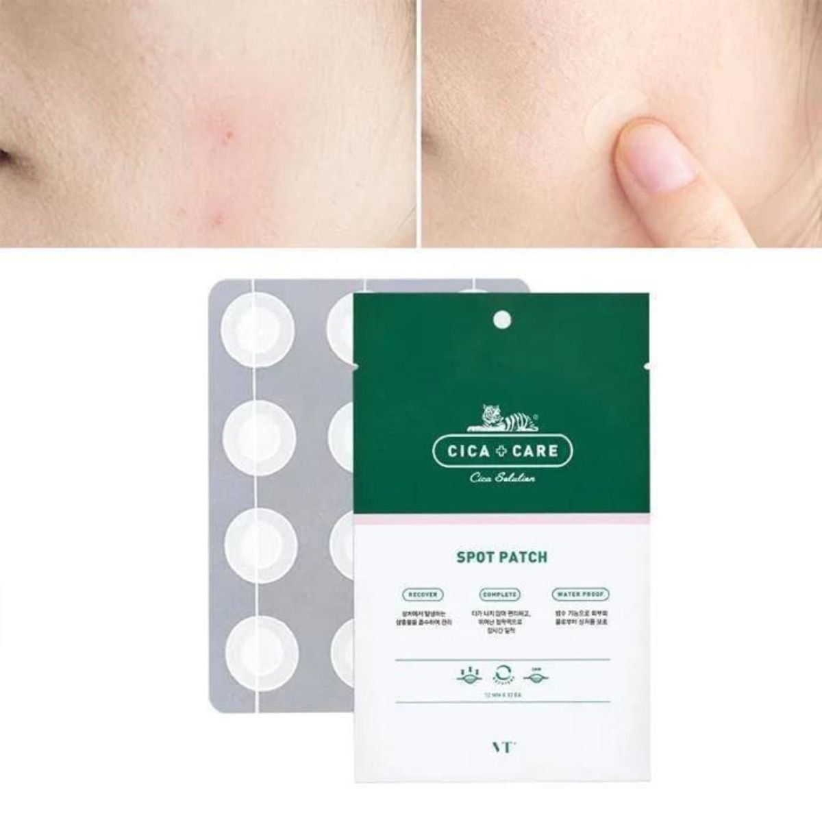 VT Spot Patch (3sets, 48ea)