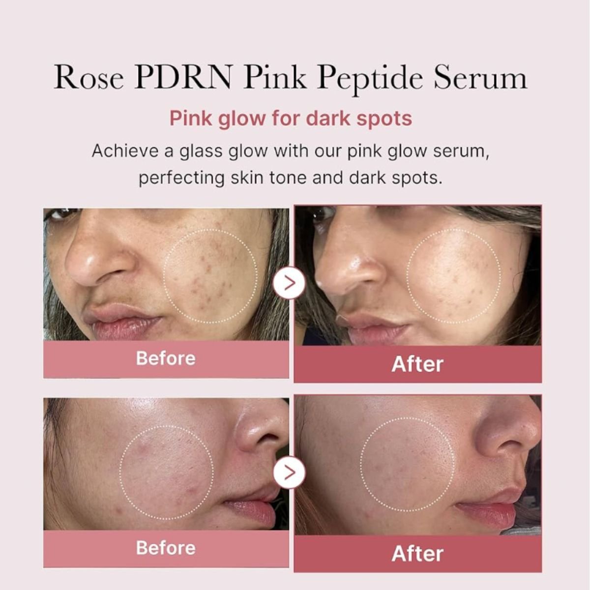 PDRN Pink Peptide Serum 30mL