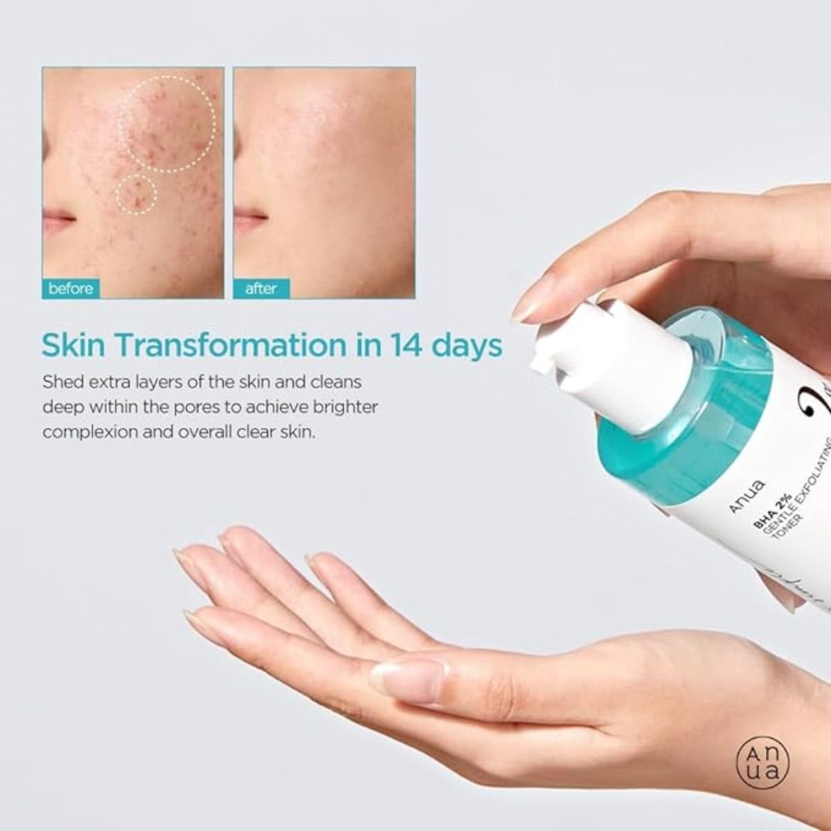 BHA 2% Gentle Exfoliating Toner 150mL