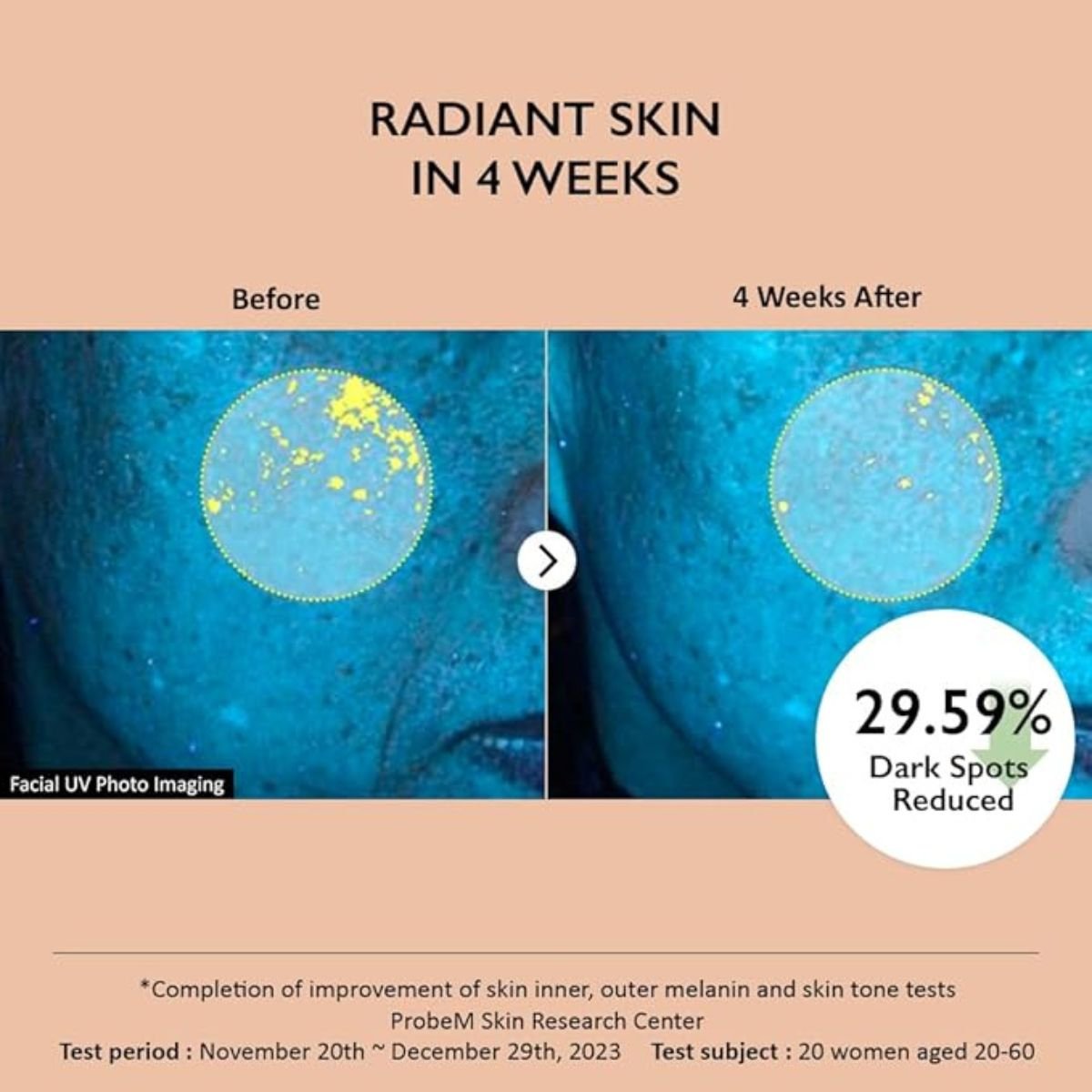 Centella 4% TXA Dark Spot Go Away Serum 30mL