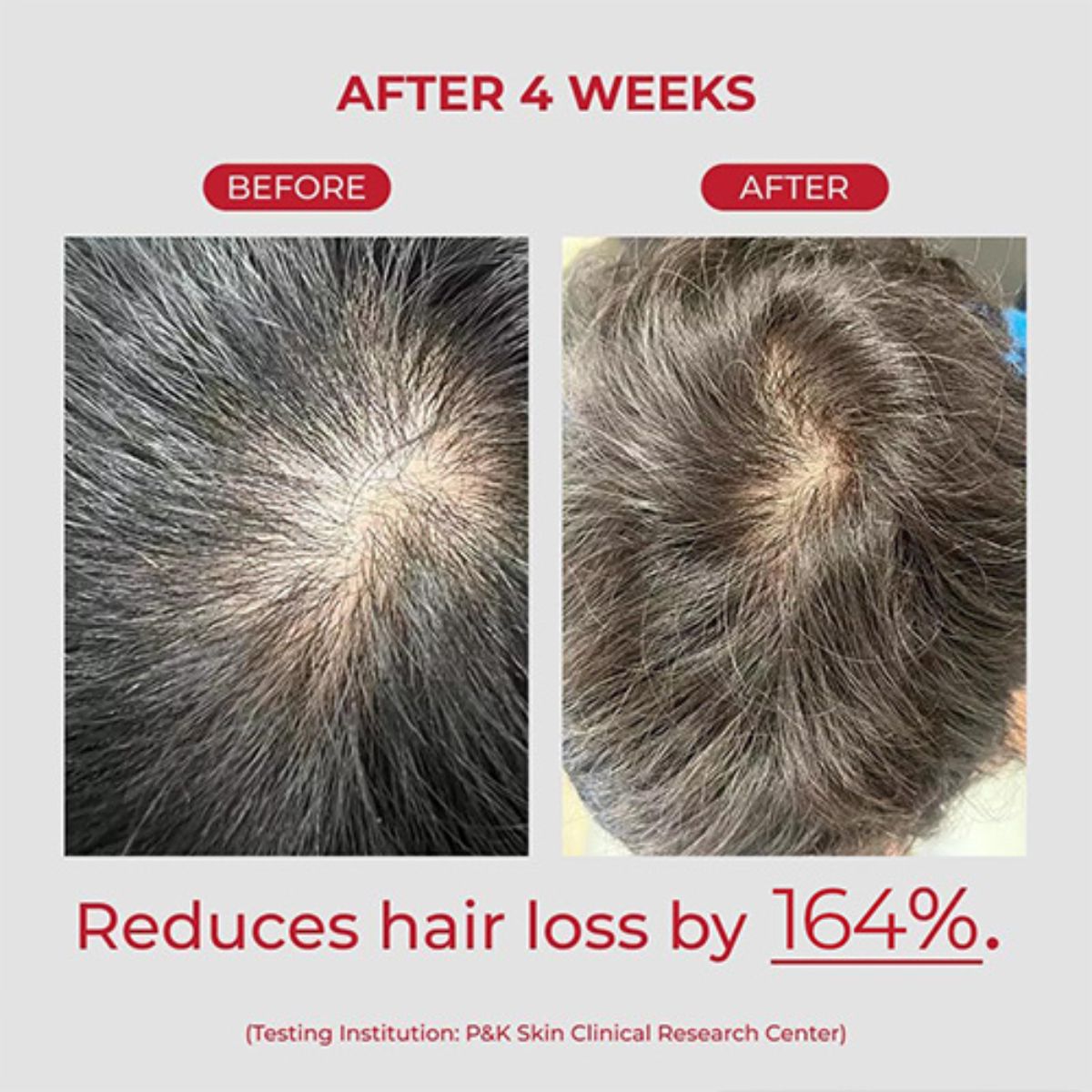 Annurcatin Shampoo 525mL