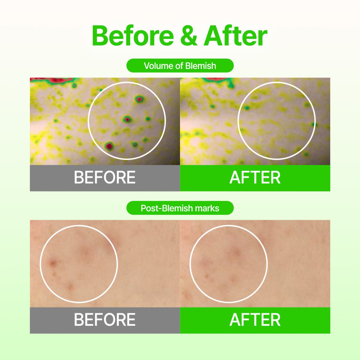 Dark Spot Care (6patches)