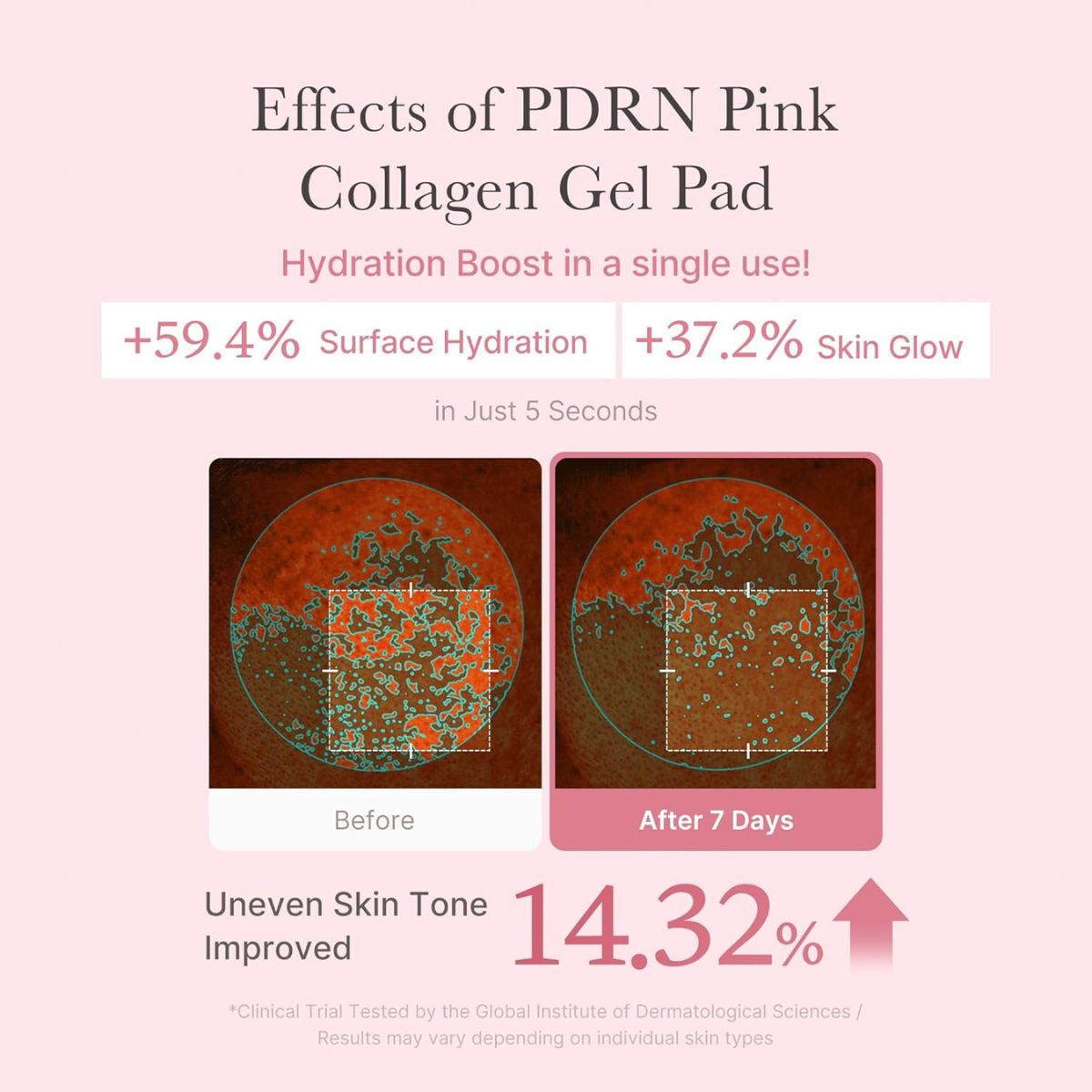 PDRN Pink Collagen Toning Gel Toner Pad 70ea