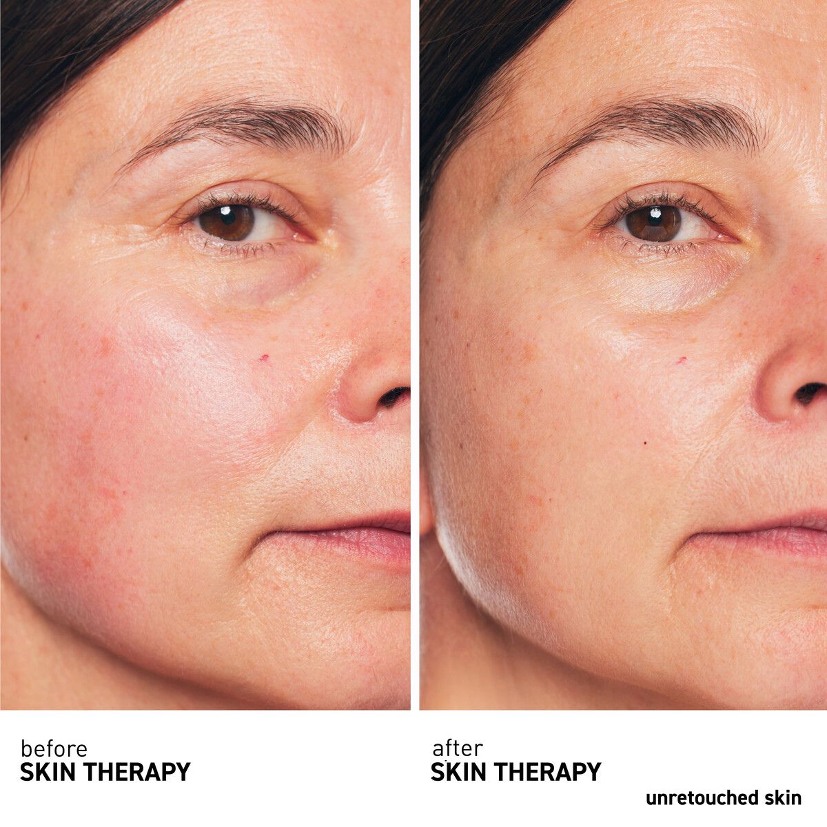 Skin Therapy Lacté 30mL
