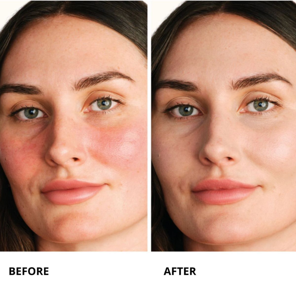 Centella Red Sérum 30mL