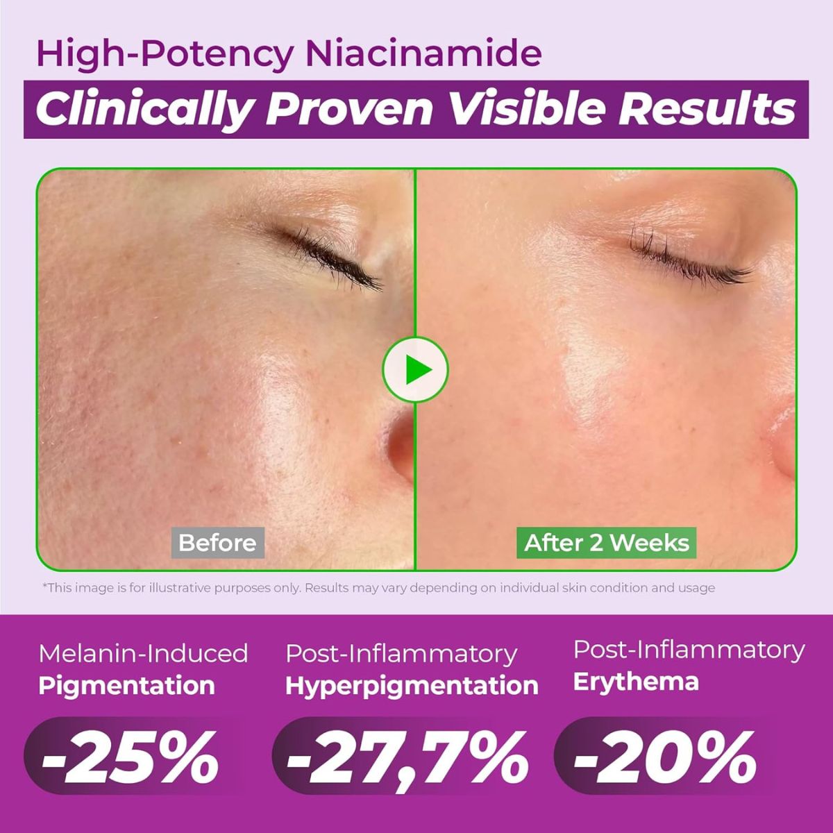 Niacinamide 20 Serum 40mL