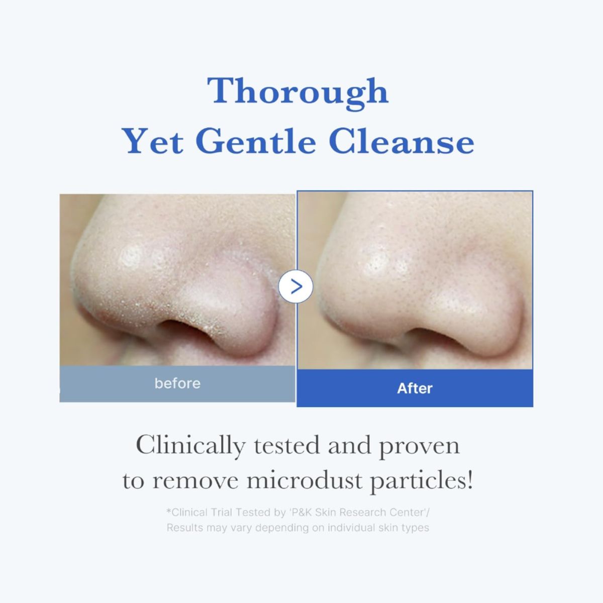 Zero Foam Cleanser 120g