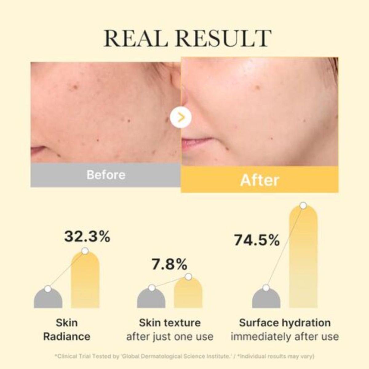 Kojic Acid Turmeric Brightening Gel Mask 4ea