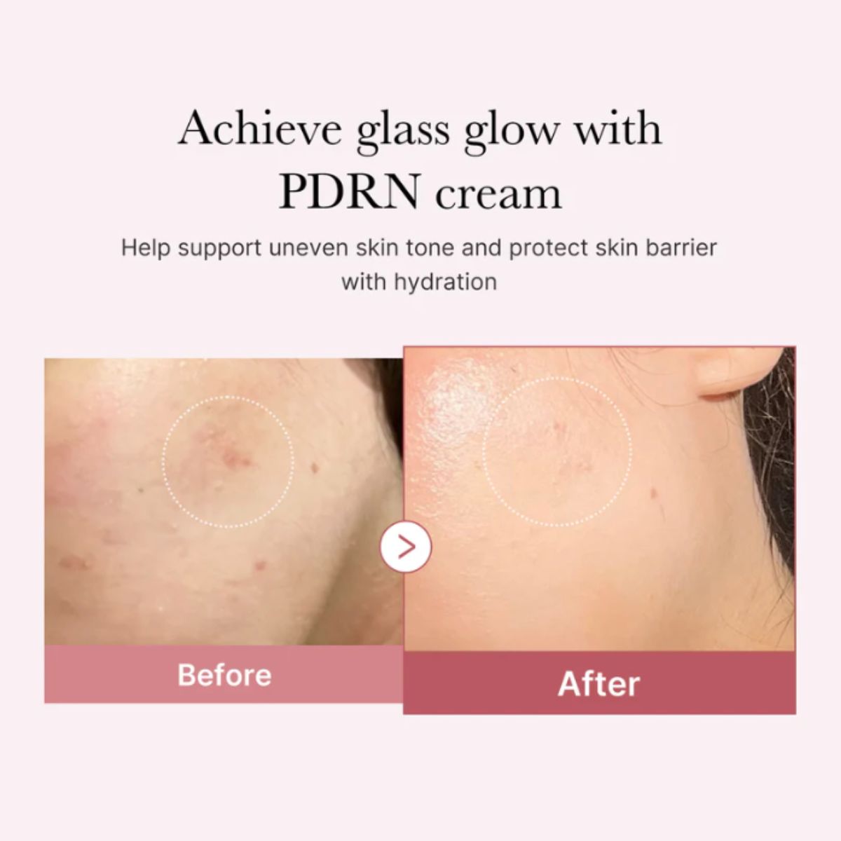 PDRN Pink Hyaluronic Moisturizing Cream 50mL