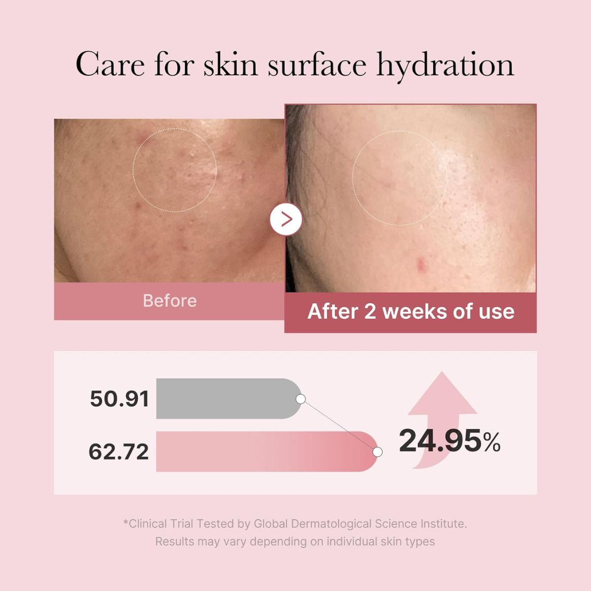 PDRN Pink Glutathione Serum Mist 100mL