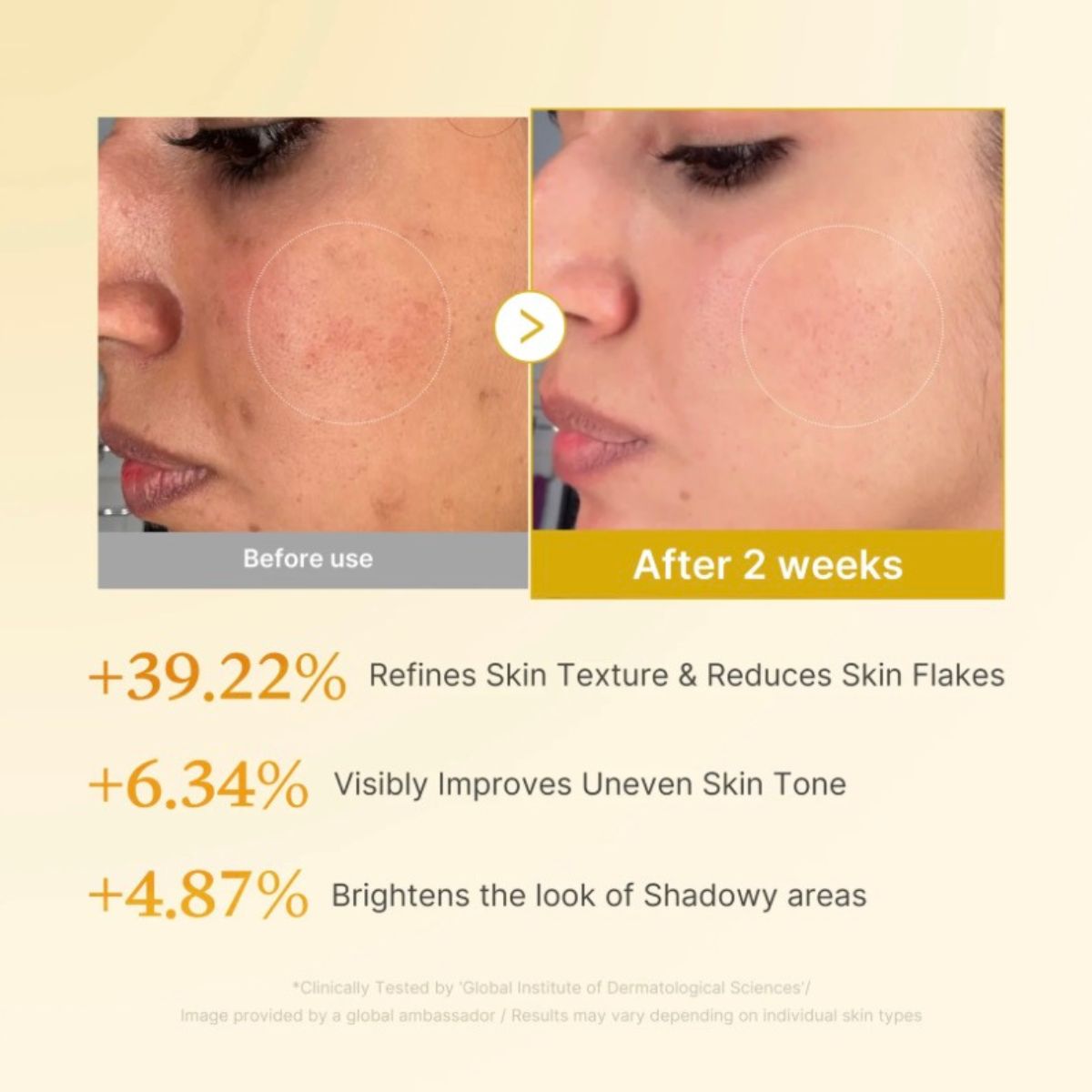 Kojic Acid Turmeric Resurfacing Toner 250mL