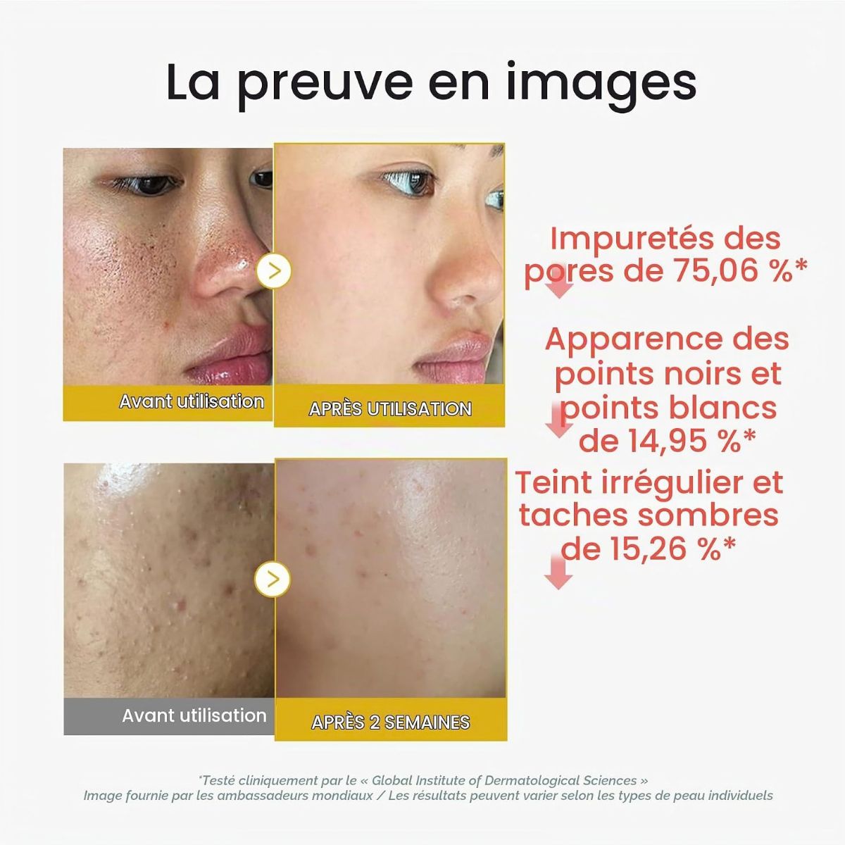 Kojic Acid Turmeric Peel Shot 80mL