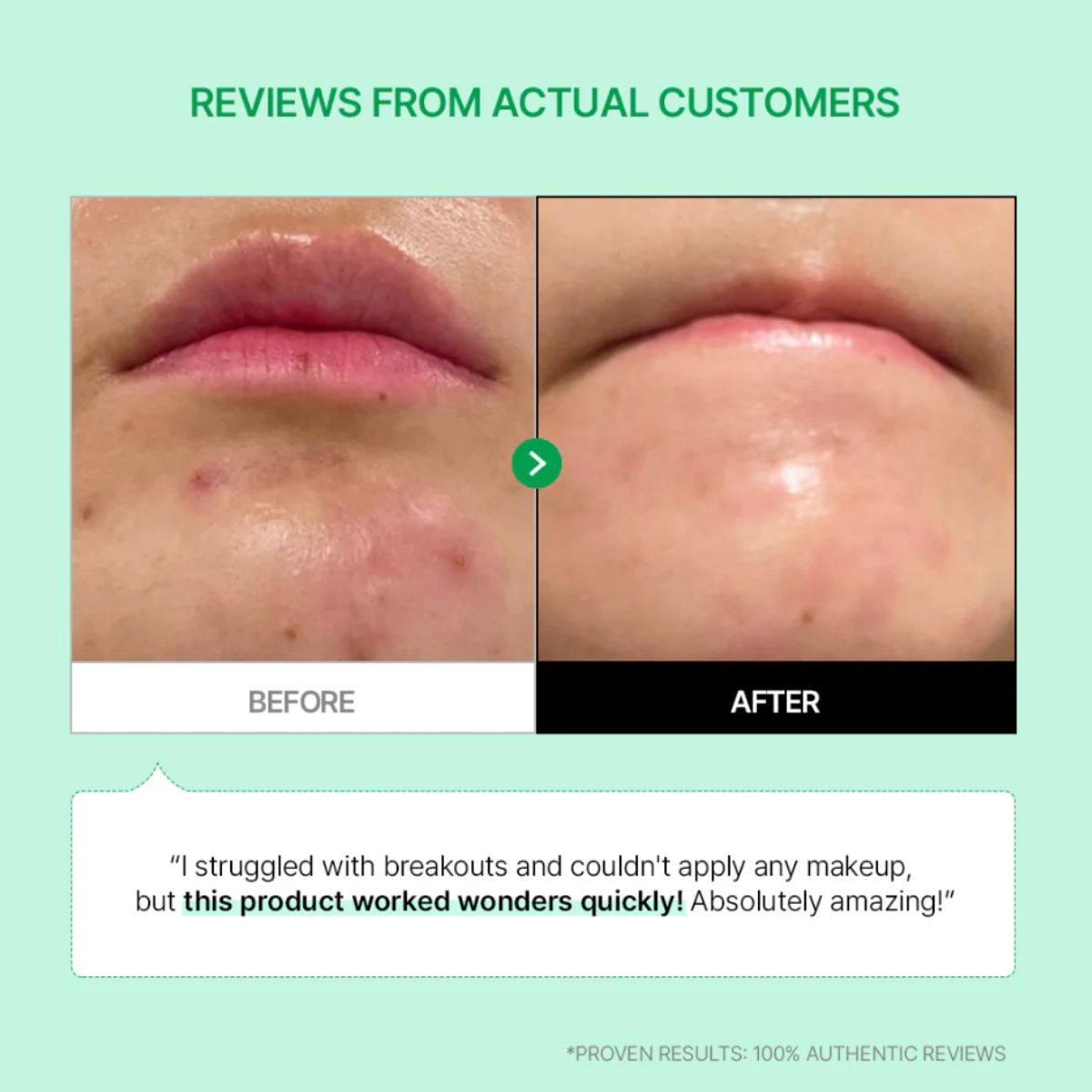 Cicamanu 92 Serum 30mL