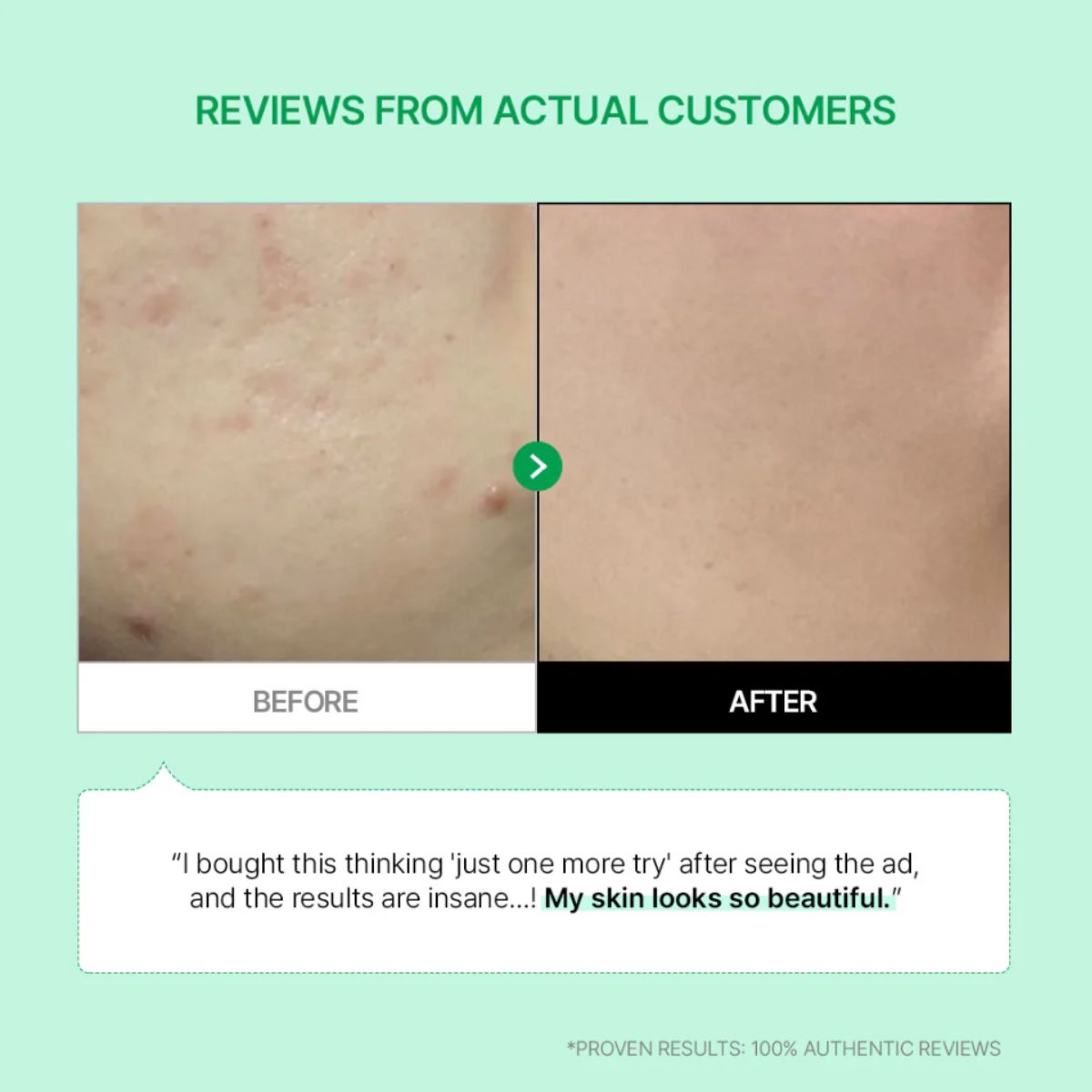 Cicamanu 92 Serum 30mL