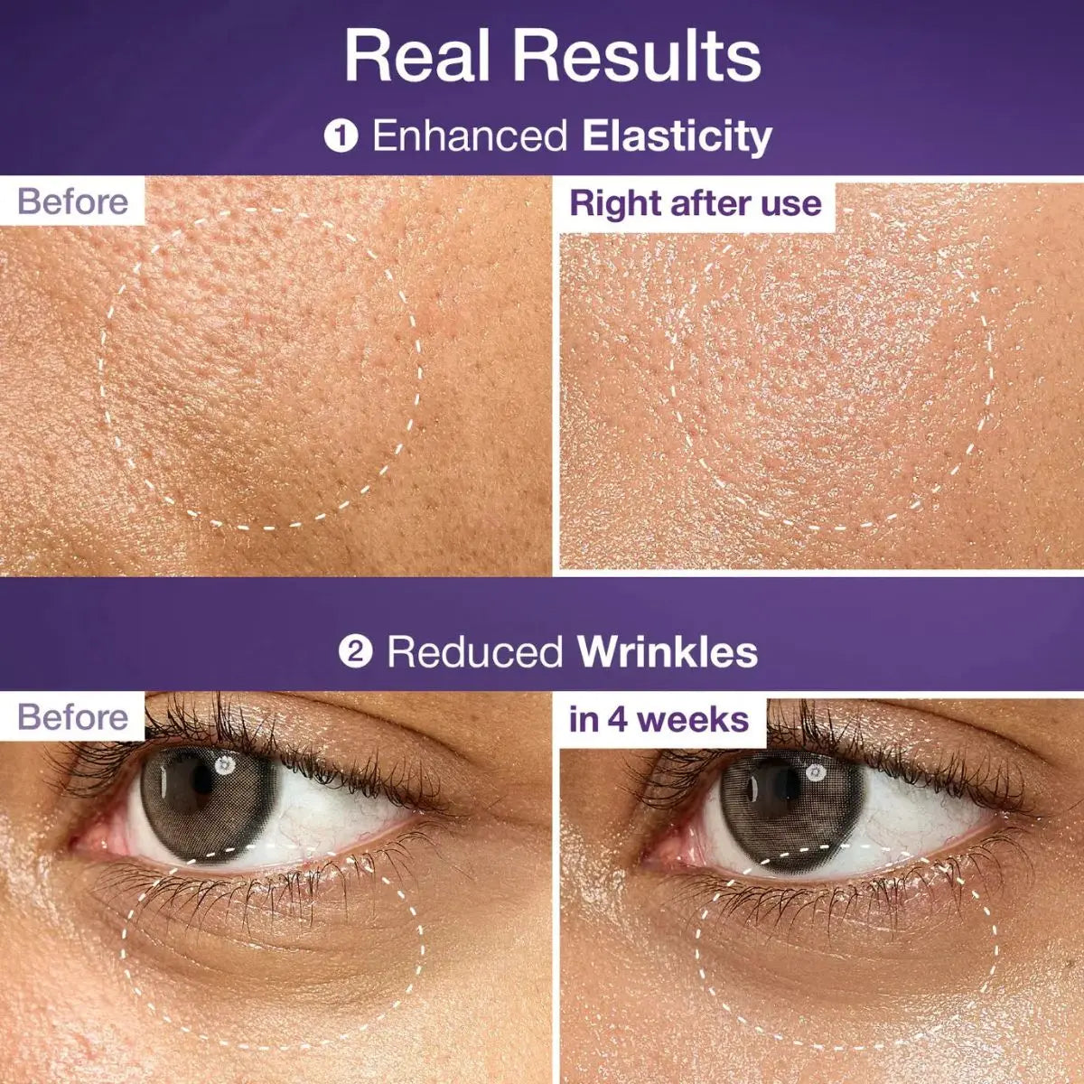 Avant / Après du No.9 NAD Bio Lifting Essence 50mL