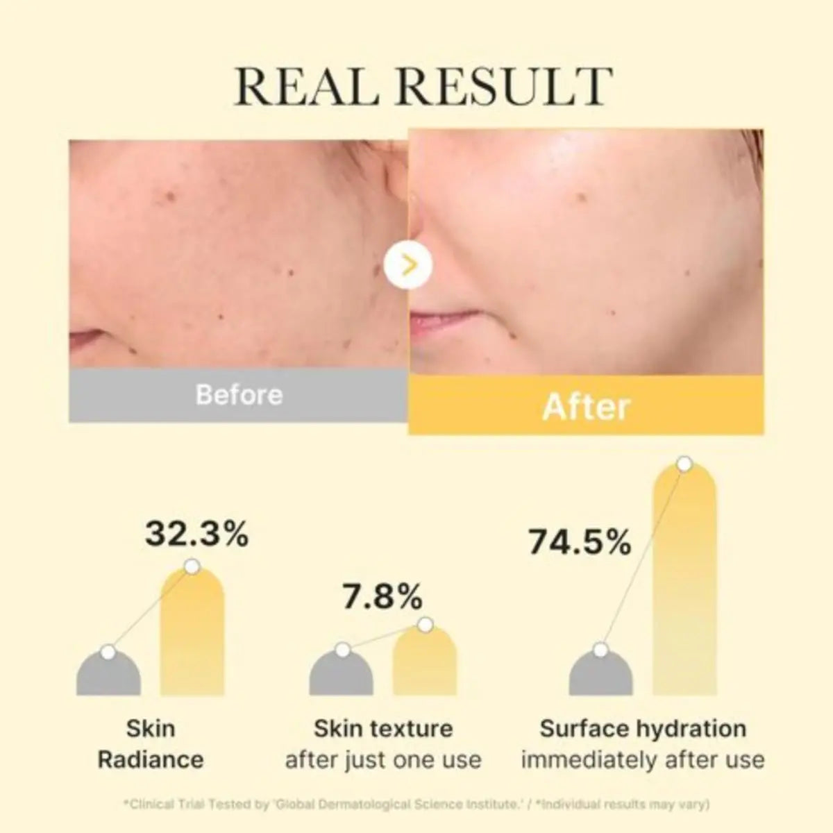 Résultat du Kojic Acid Turmeric Brightening Gel Mask 