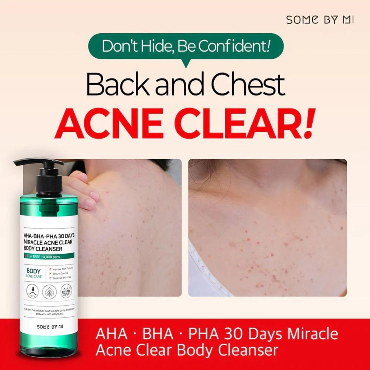 AHA BHA PHA 30 Days Miracle Clear Body Cleanser 400g