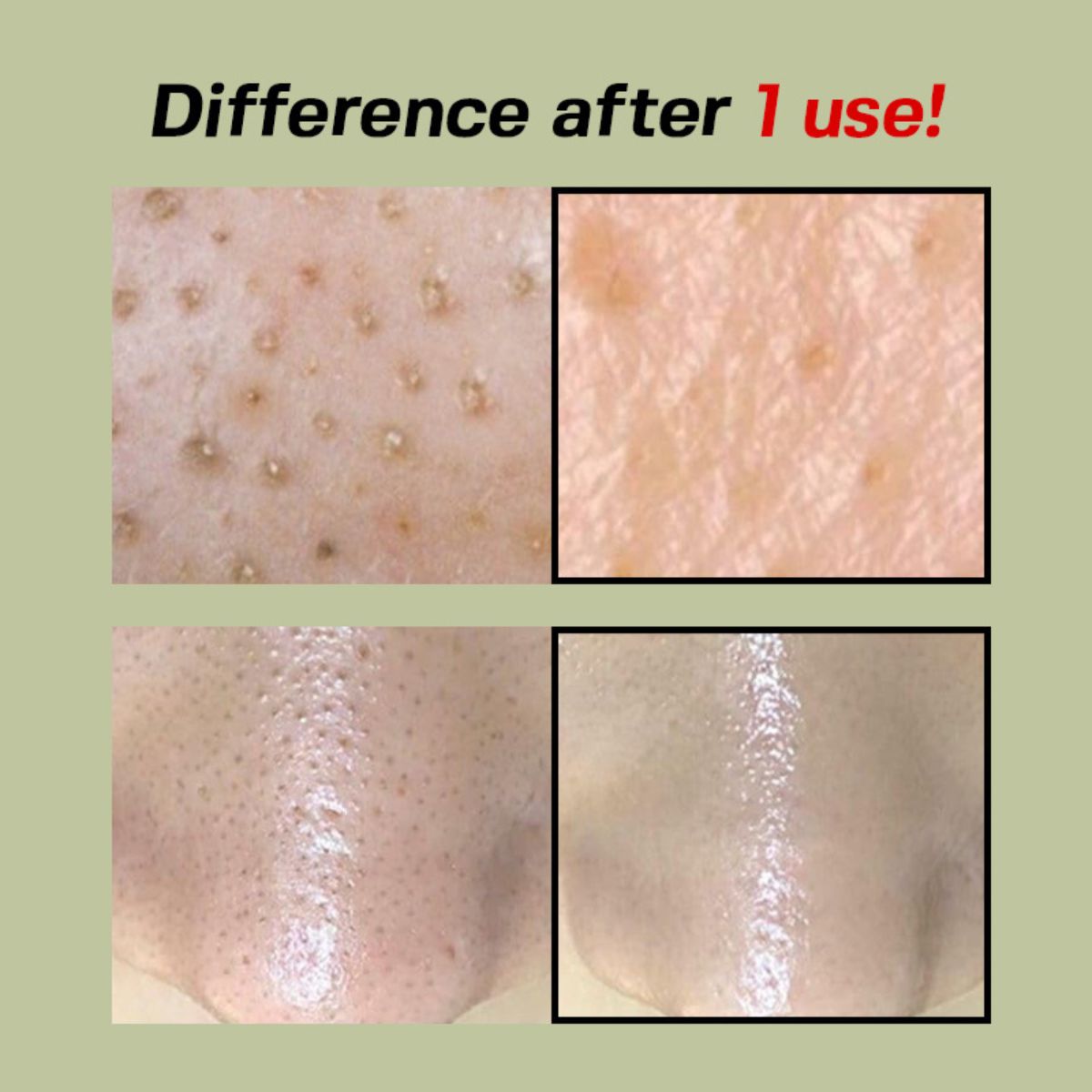 Green Tomato Pore Peeling Jumbo Pad (60ea)