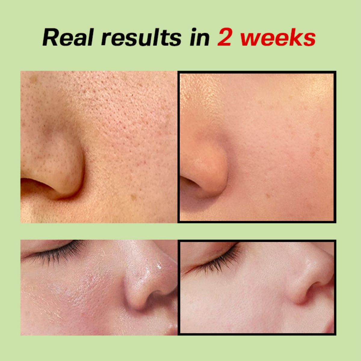 Green Tomato Pore Lifting Ampoule+ 30mL