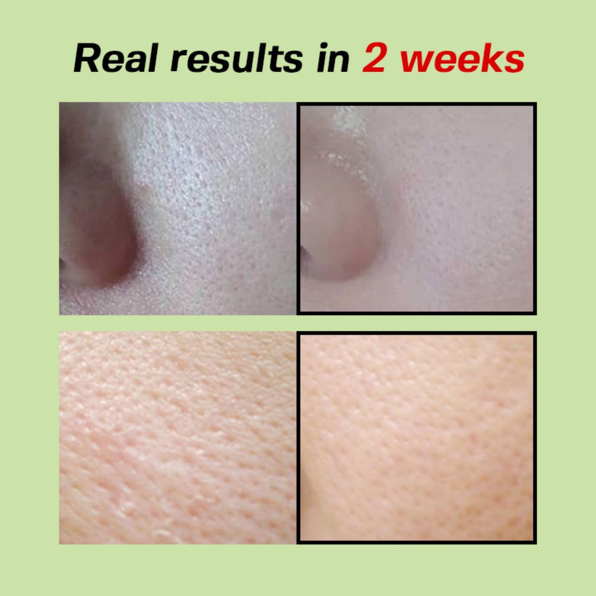 Green Tomato Pore Lifting Ampoule+ 30mL
