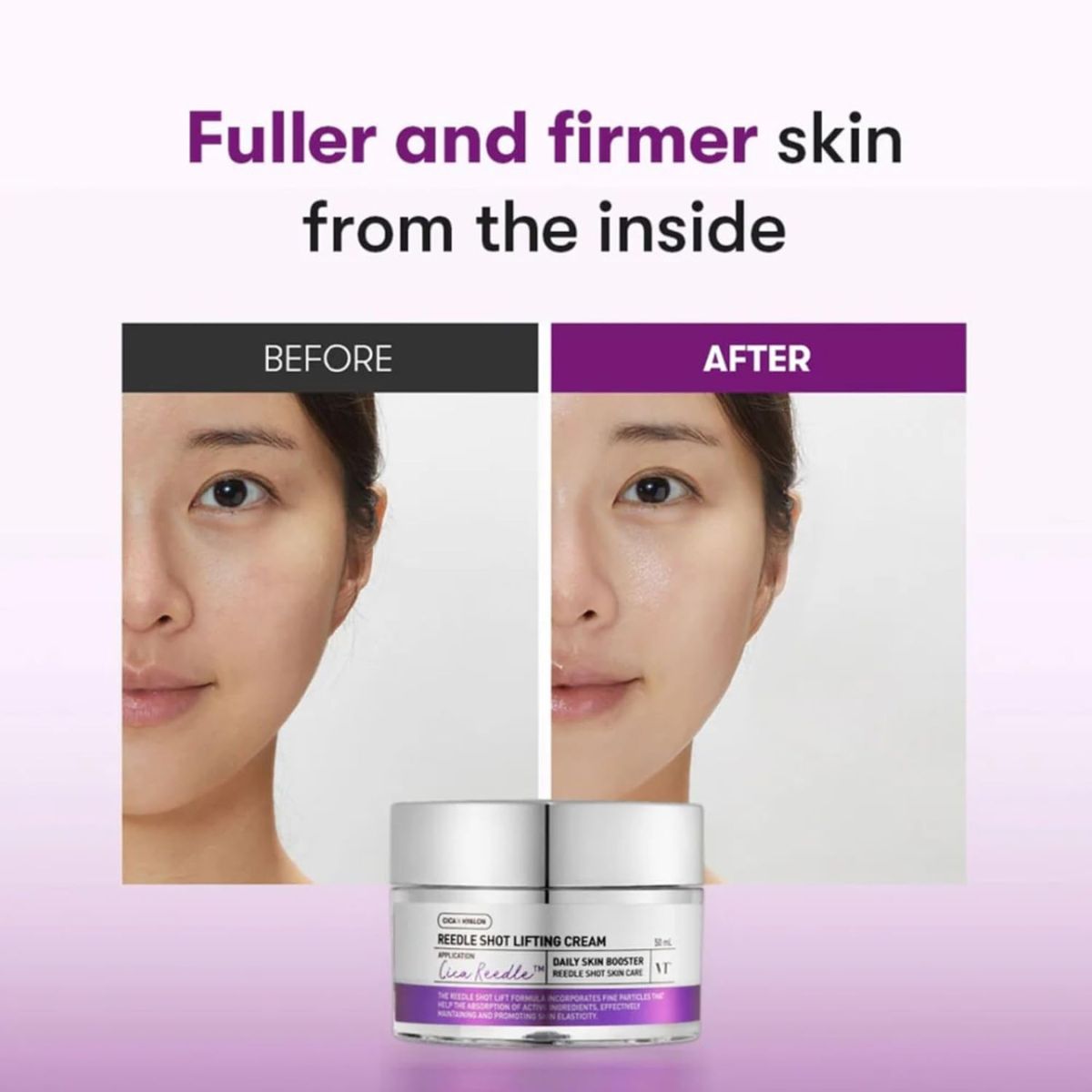 Reedle Shot Lifting Cream 50mL