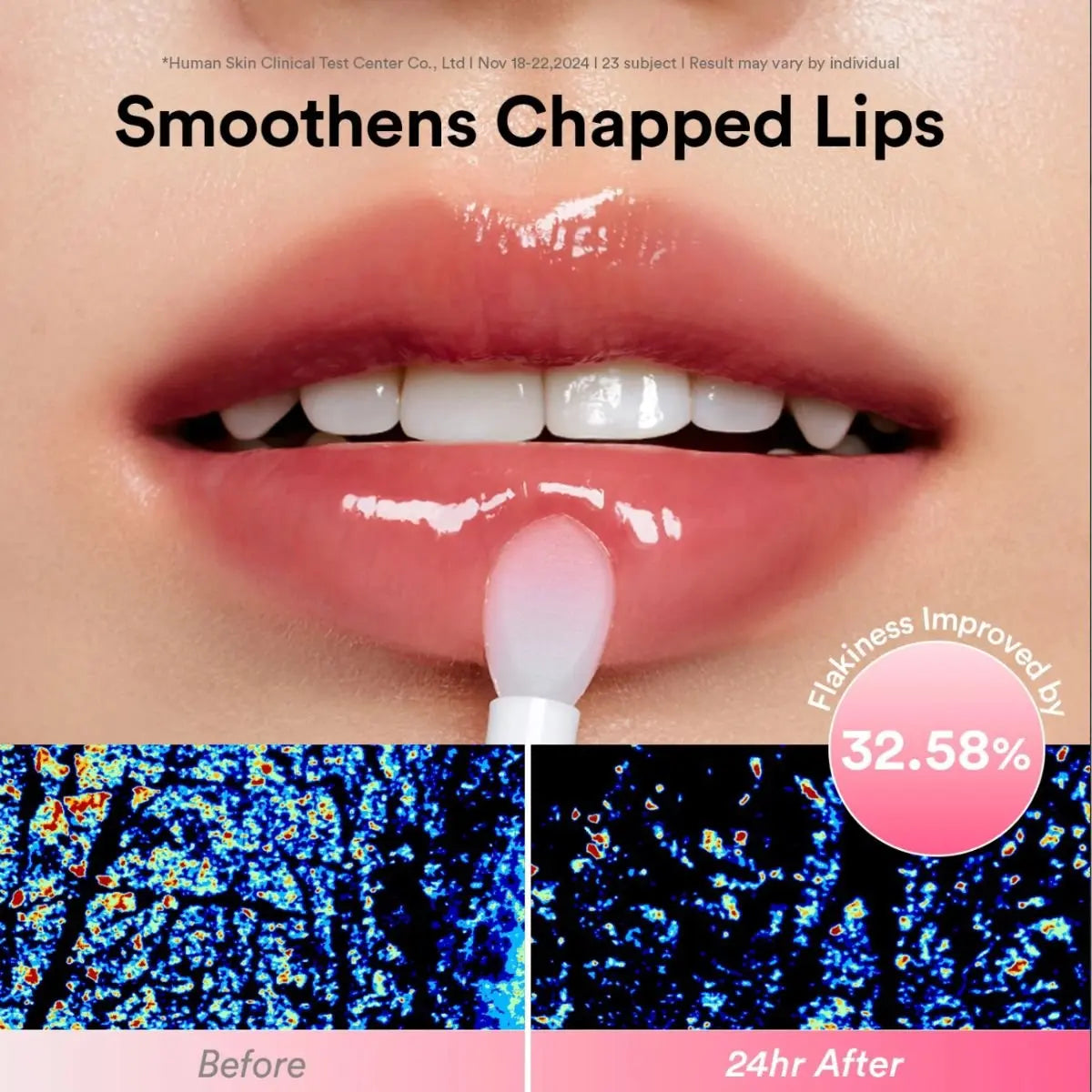 Infographie avant-après montrant des lèvres hydratées après application du baume rose, avec résultat clinique 32,58 % d’amélioration.