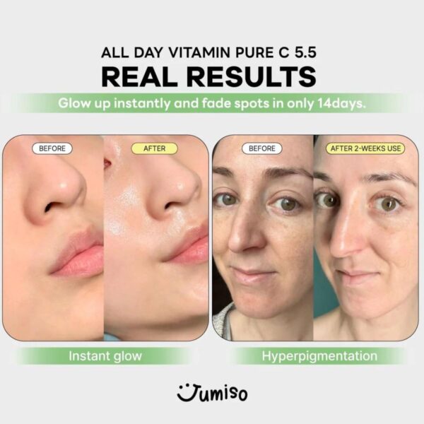 All Day Vitamin Pure C 5.5 Glow Serum 30mL - Image 3